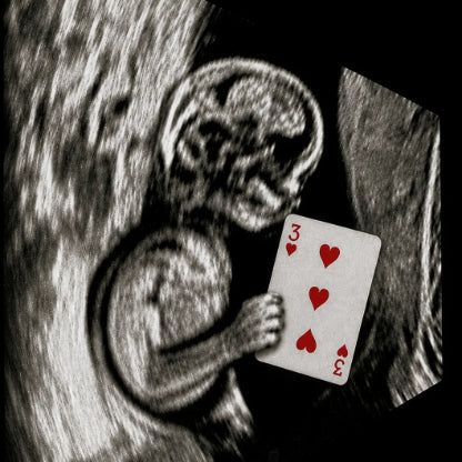 Ultrasound 2.0 by Iain Bailey